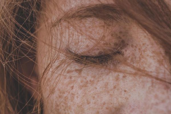 Estrogeni: perché sono anti-age per la pelle